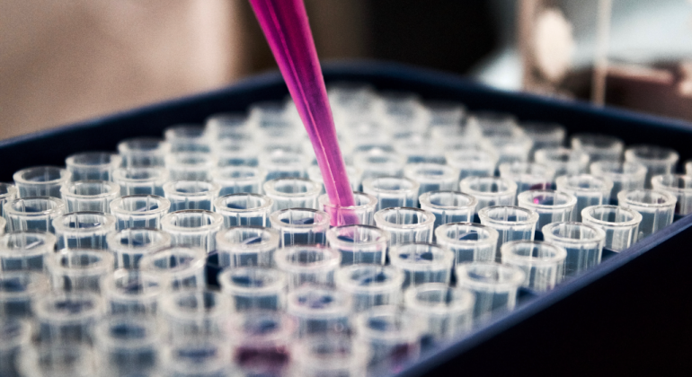 Brazilian scientists discover super therapy to cure AIDS